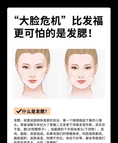 发腮