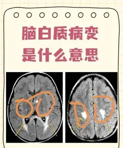 髓鞘