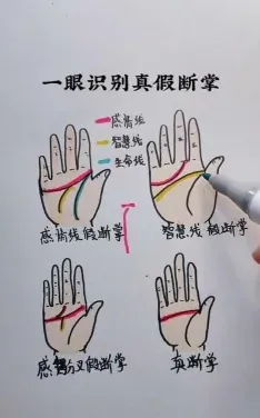 断掌