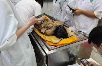 人体解剖学